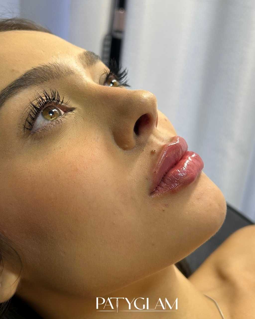 Antes - procedimento estético