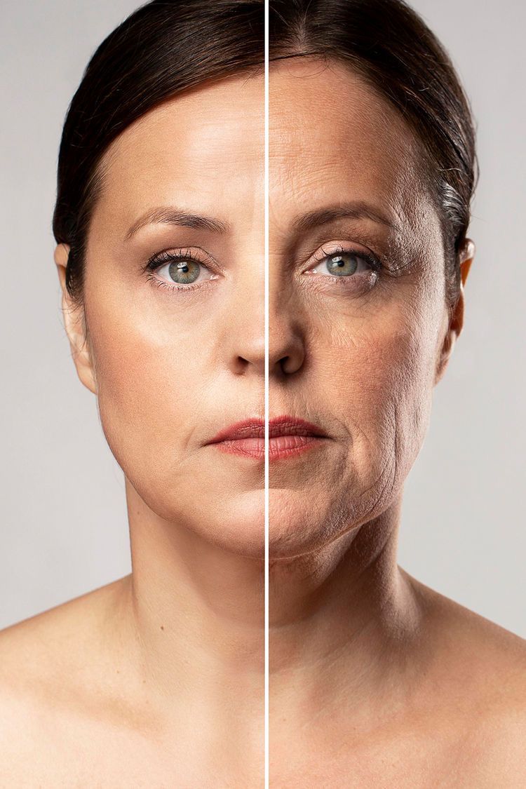 Bioestimulador de Colágeno